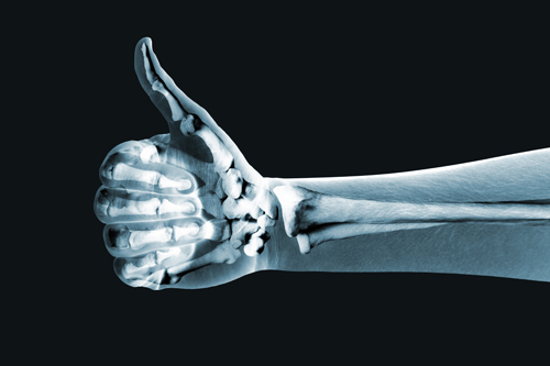 What’s to Learn From an Arthritic Hand?