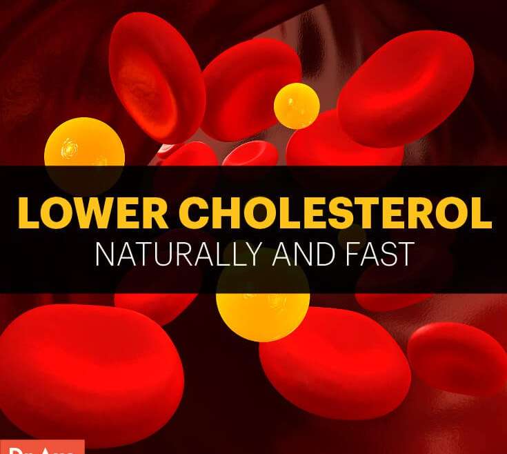 Lower Your Cholesterol Naturally and Fast by Dr Josh Axe