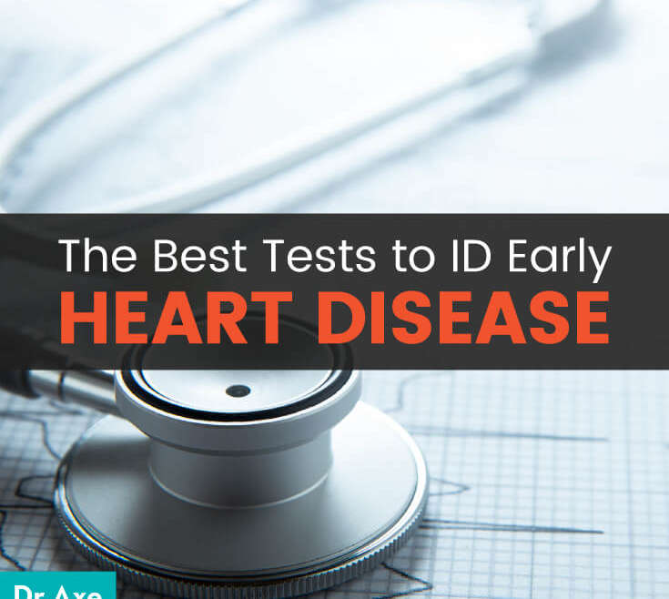 These 5 Heart Disease Tests Could Save Your Life (And Your Doctor Probably Isn’t Ordering Them)